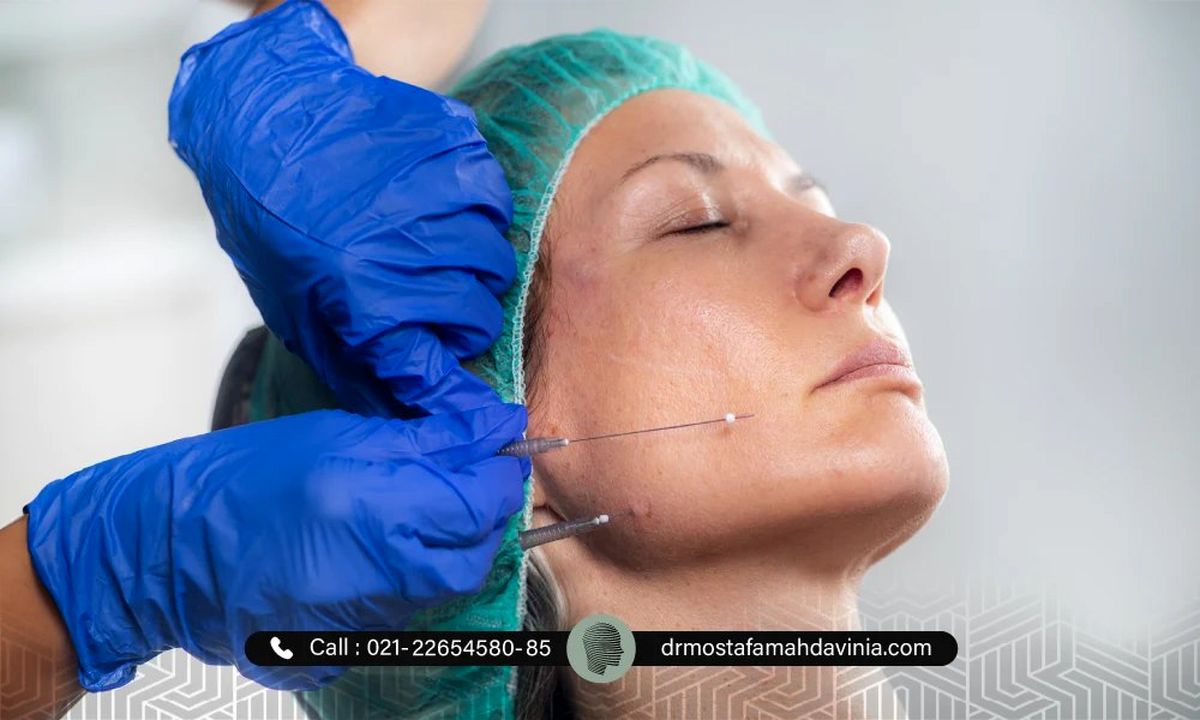 ورم صورت بعد از لیفت با نخ: علل، درمان ها و نکات مراقبتی برای بهبودی سریع